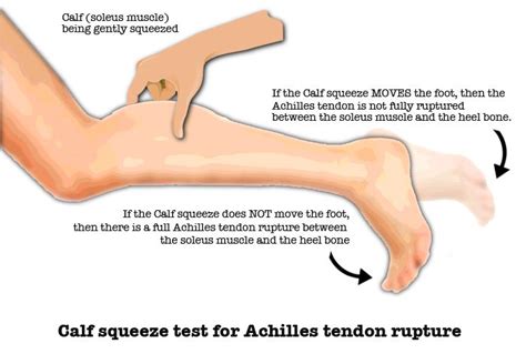 thompson test positive means